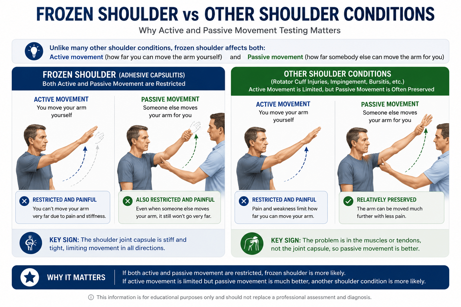 Infographic comparing active and passive shoulder movement in frozen shoulder versus other shoulder conditions, showing that frozen shoulder restricts both active and passive range of motion.