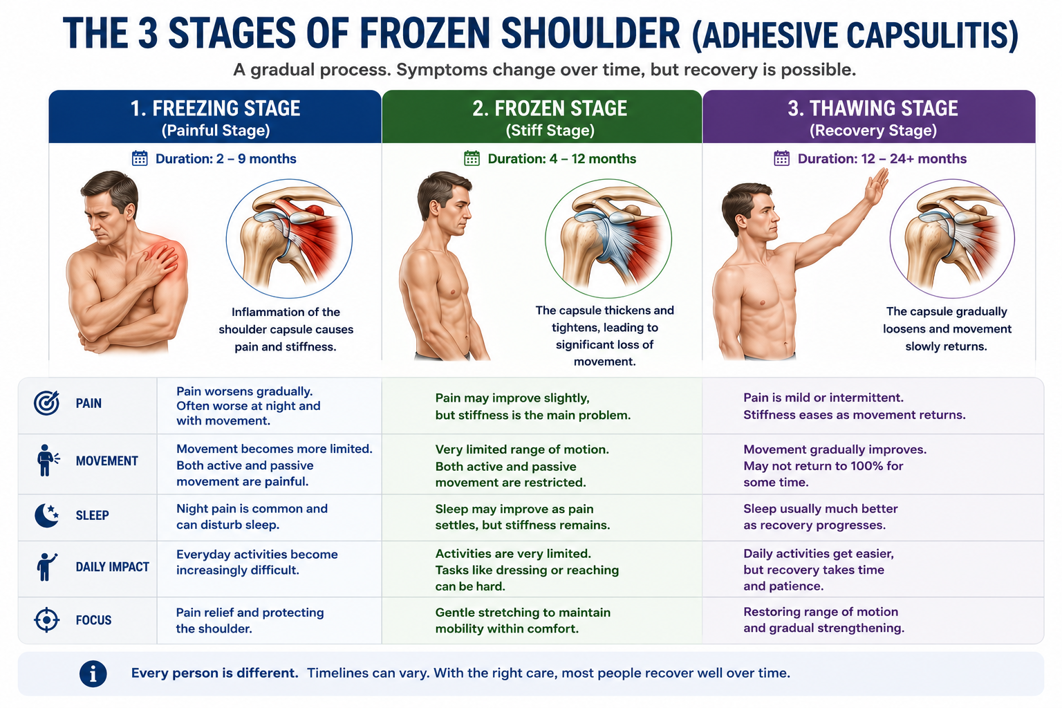 Infographic showing the three stages of frozen shoulder (adhesive capsulitis): freezing stage, frozen stage and thawing stage, including symptoms, duration, pain levels, movement restriction and recovery.
